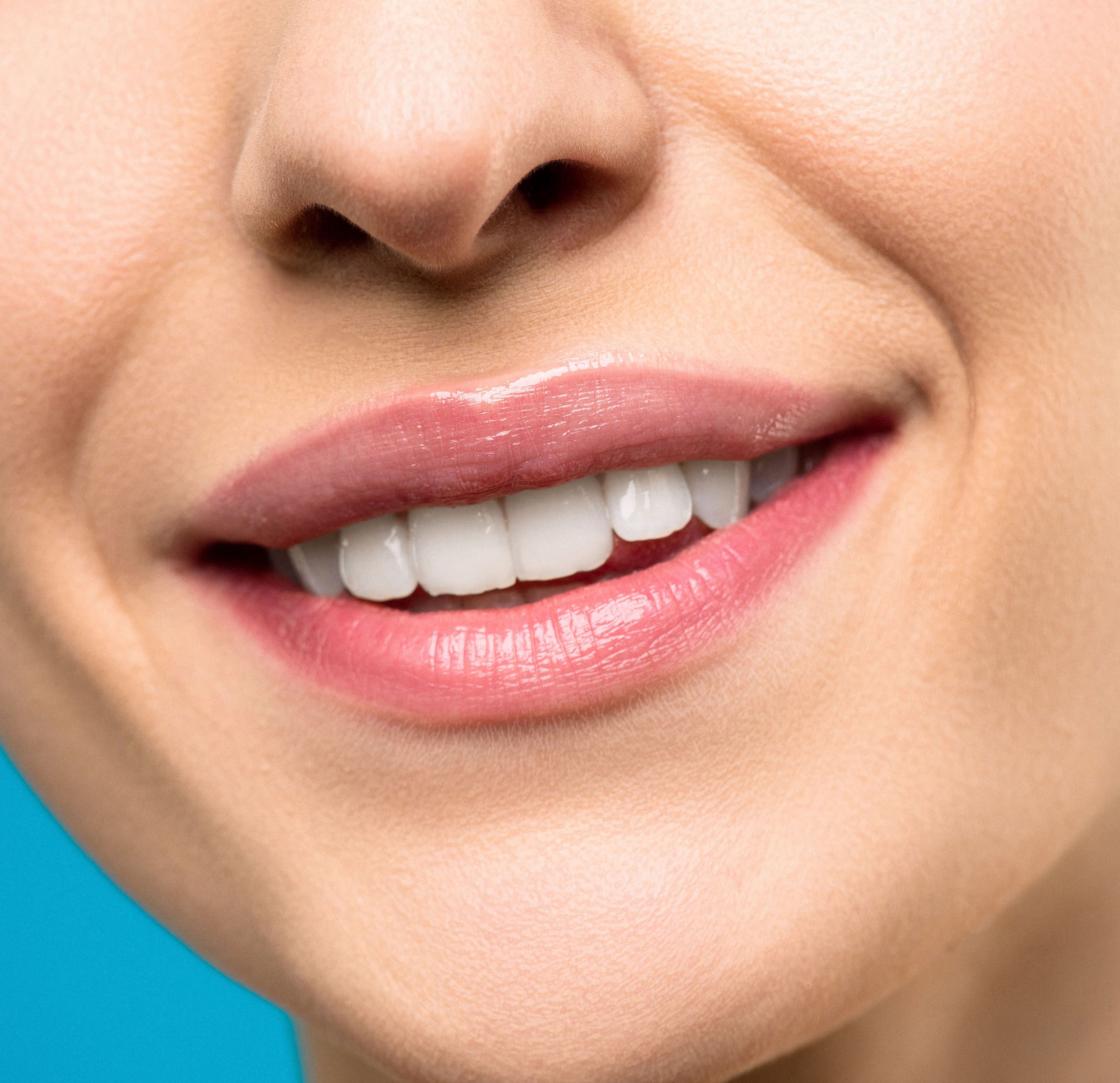 Close-up of a healthy smile after CDCP Dentist in Welland at Rose City Dental Centre