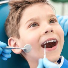 Know the Stages of Root Canal Treatment