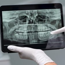 Digital X-Rays: How They’re Improving Patient Care and Diagnosis