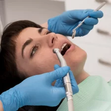 Lost Your Dental Filling? Here’s What to Do Next
